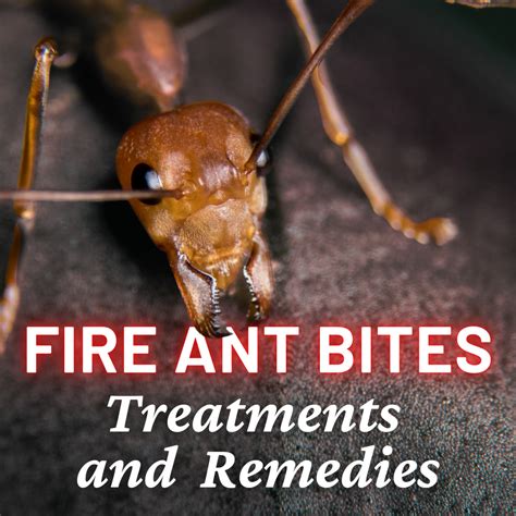 fire ants bites treatment